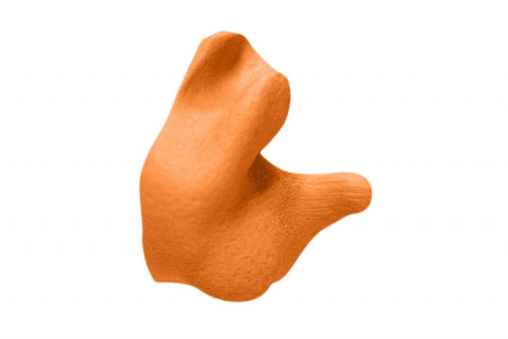 Radians Custom Molded Earplugs Review in 2024 Are They Worth It?