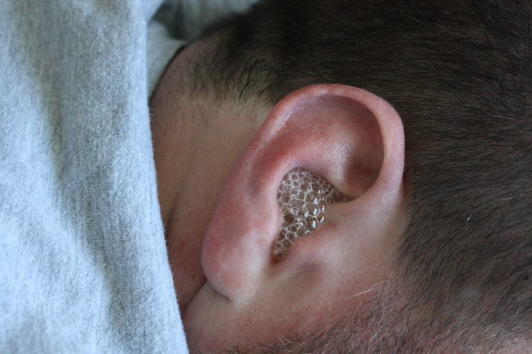 Hydrogen Peroxide Being Used in Ears What You Need to Know DoctEar